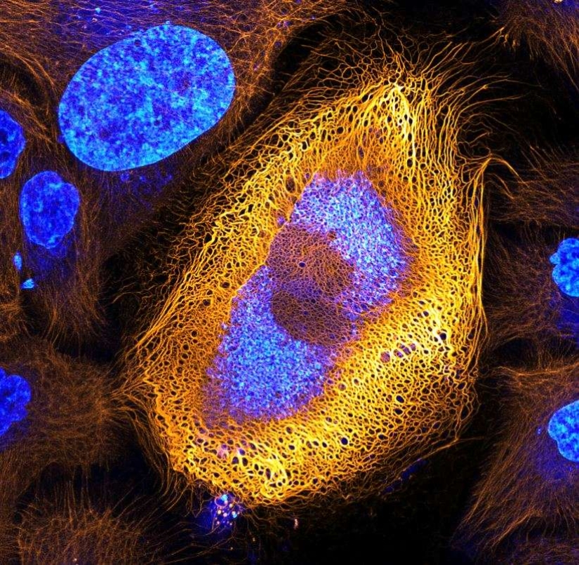 El sexo de los gorgojos, la cabeza de un gusano, la belleza del moho: el concurso de fotografía Nikon Small World anunció a los ganadores