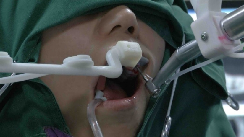 En China, un dentista robot insertó dientes humanos por primera vez