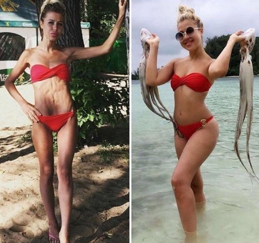 En el cautiverio de Kashchey: la delgadez mortal casi mata a las hermanas gemelas de Rusia