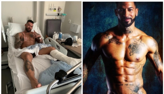 Erotic collapse: a stripper broke his leg and knocked out a grandmother after falling from a pole