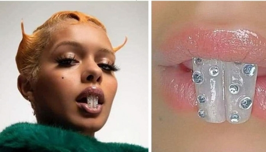 Está de moda? Te doy un diente! Cómo la moda indignante se deslizó en la odontología Está de moda? Te doy un diente! Cómo la moda indignante se deslizó en la odontología