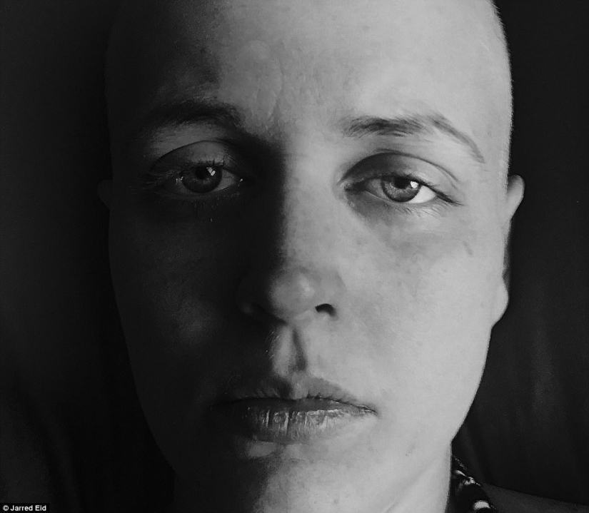 "Estarás bien": fotógrafa captura a su esposa y su batalla contra el cáncer