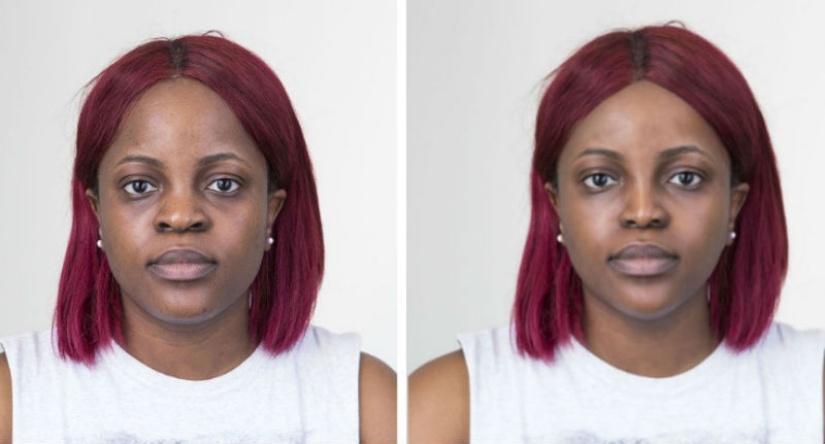 Estándares de belleza de cirujanos plásticos surcoreanos