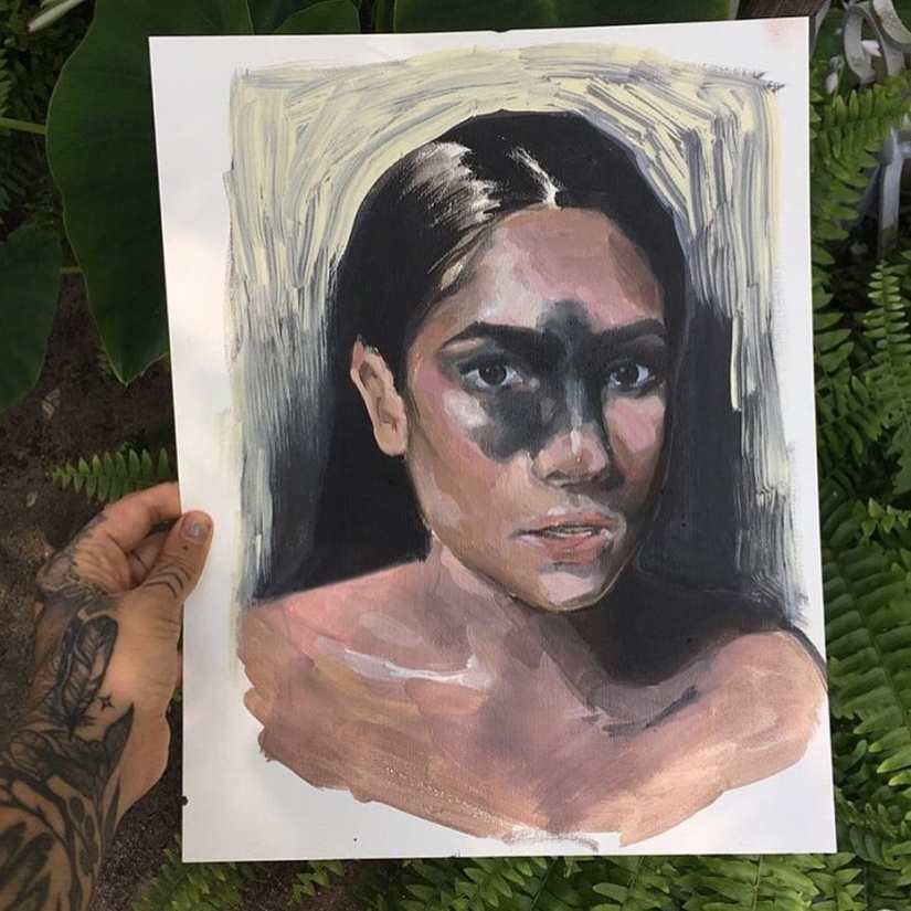 Everyone mocked this girl because of her birthmark, and she took and became a model Everyone mocked this girl because of her birthmark, and she took and became a model