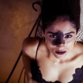 Everyone mocked this girl because of her birthmark, and she took and became a model