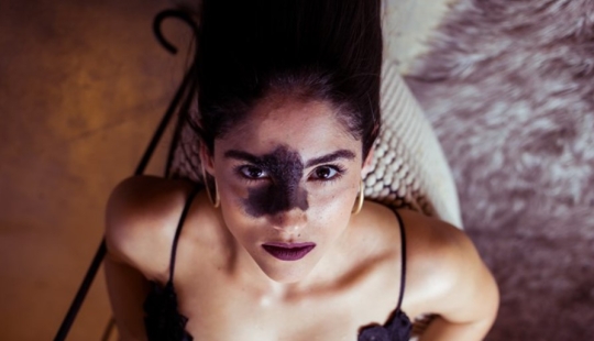 Everyone mocked this girl because of her birthmark, and she took and became a model