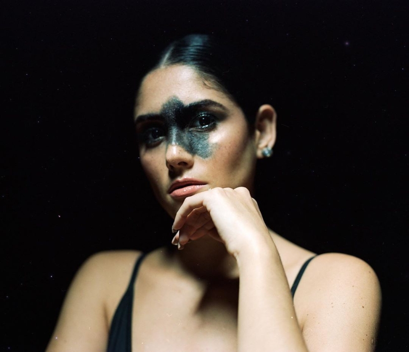 Everyone mocked this girl because of her birthmark, and she took and became a model Everyone mocked this girl because of her birthmark, and she took and became a model