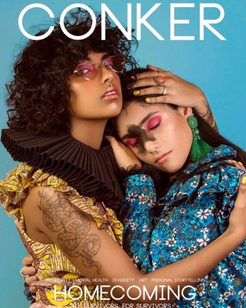 Everyone mocked this girl because of her birthmark, and she took and became a model Everyone mocked this girl because of her birthmark, and she took and became a model