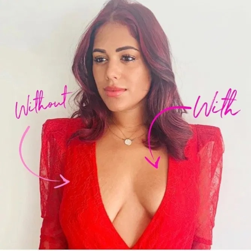 Everything ingenious is simple: twin sisters earned a million on a cheap breast lift