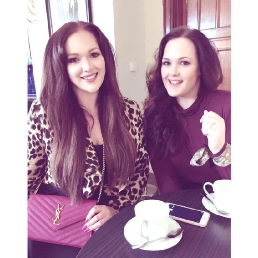 Everything ingenious is simple: twin sisters earned a million on a cheap breast lift