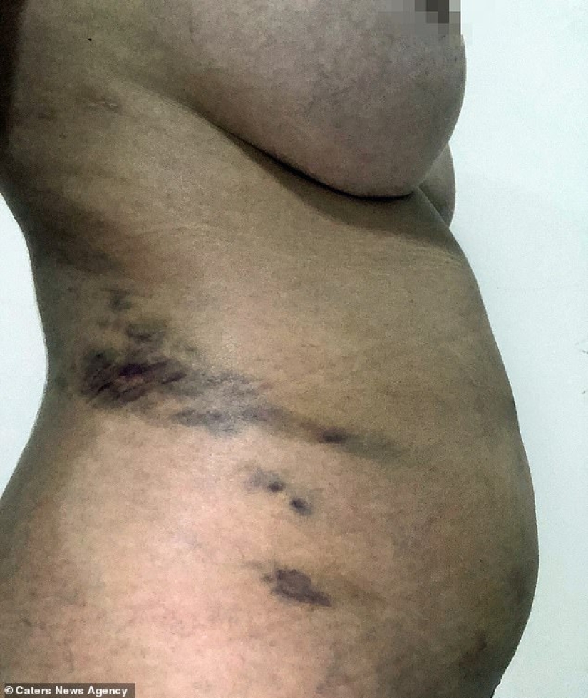 Explosive beauty: the model spent half a million dollars to look like Kim Kardashian, and almost died