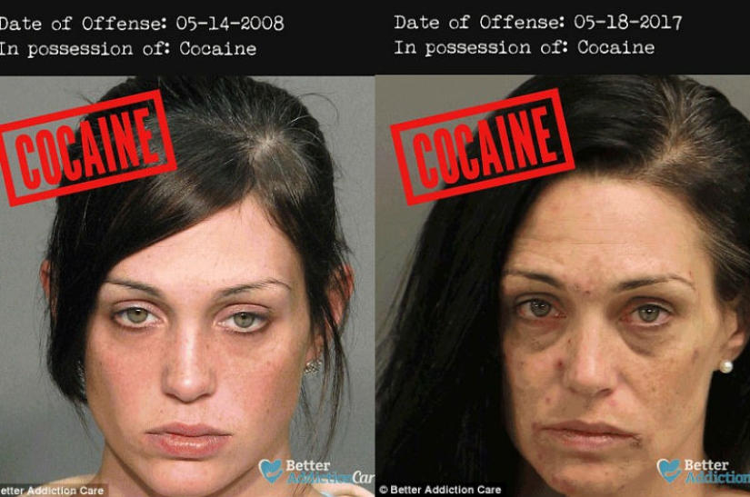 Faces of drug addicts before and after: how do banned substances affect appearance Faces of drug addicts before and after: how do banned substances affect appearance