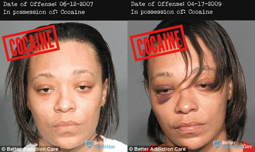 Faces of drug addicts before and after: how do banned substances affect appearance Faces of drug addicts before and after: how do banned substances affect appearance