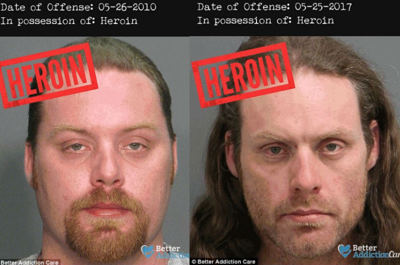 Faces of drug addicts before and after: how do banned substances affect appearance Faces of drug addicts before and after: how do banned substances affect appearance