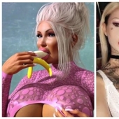 Fetish model almost died during plastic surgery on her vagina