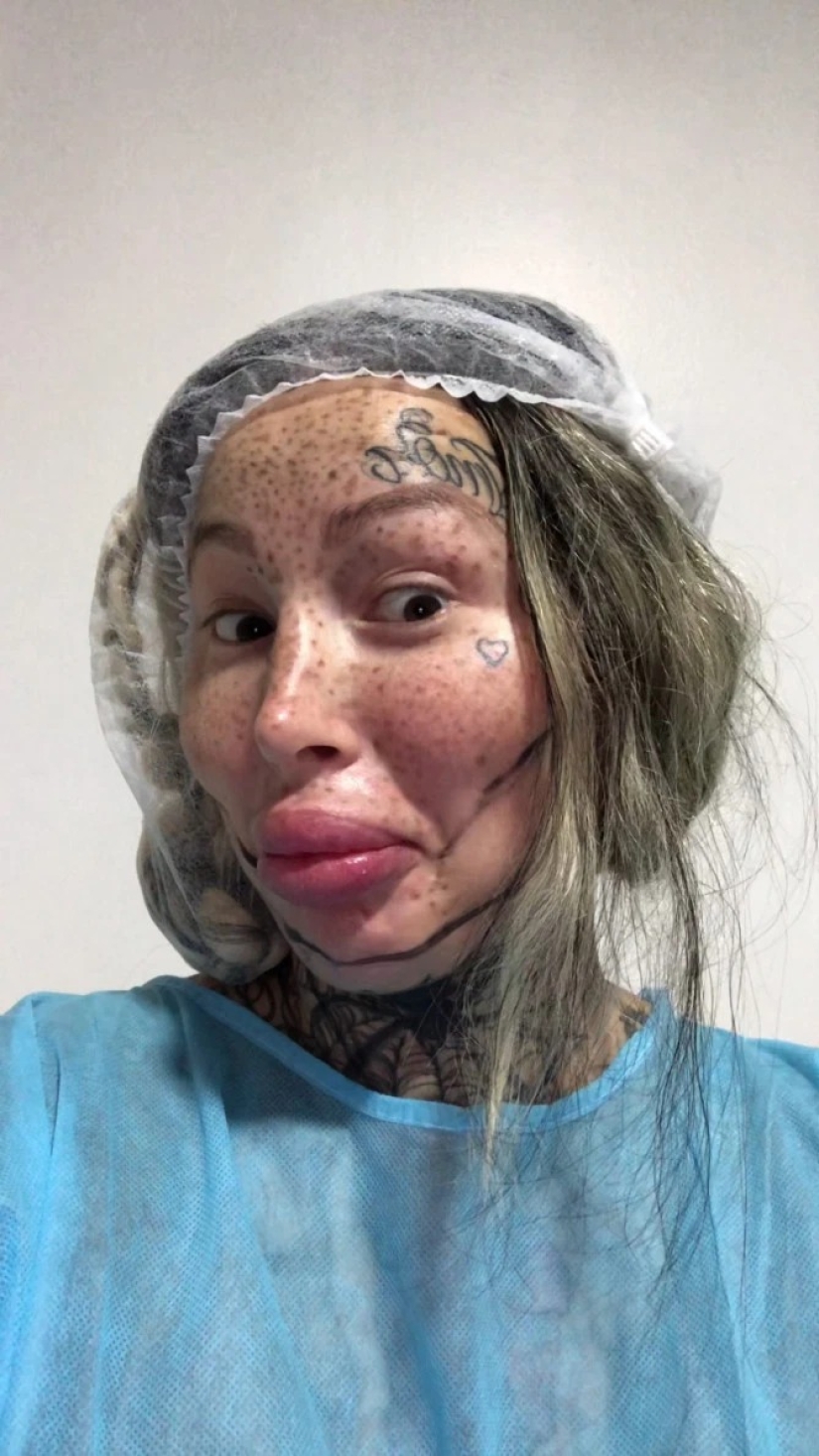 Fetish model almost died during plastic surgery on her vagina