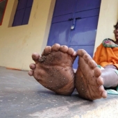 Fingers with a fan: a woman with 31 fingers got into the Guinness Book of Records