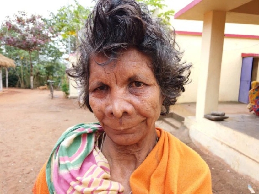 Fingers with a fan: a woman with 31 fingers got into the Guinness Book of Records