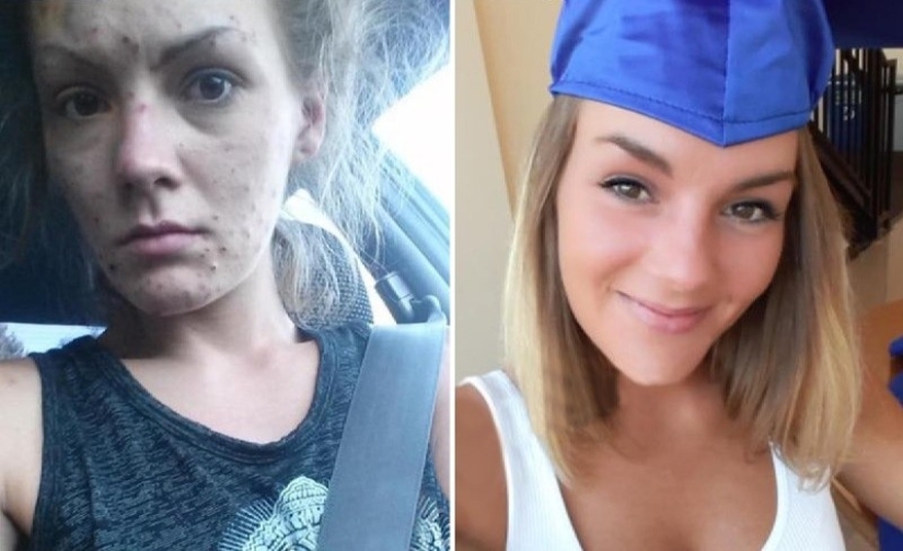 From addiction to freedom: the amazing transformation of a former drug addict