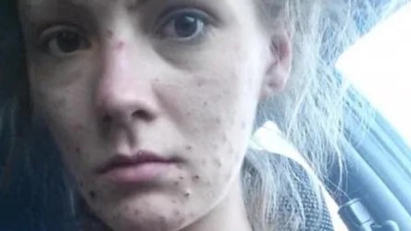 From addiction to freedom: the amazing transformation of a former drug addict