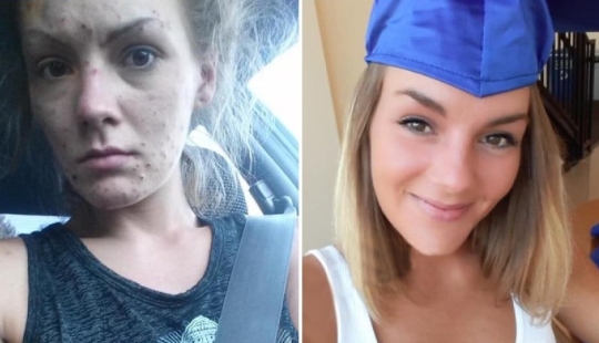 From addiction to freedom: the amazing transformation of a former drug addict