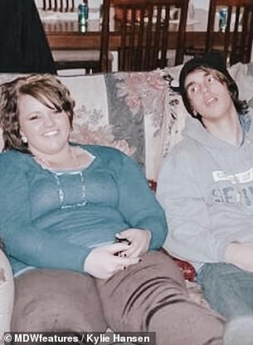 From extreme to extreme: a woman lost 50 kg, but could not stop there