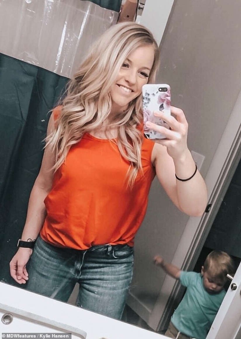 From extreme to extreme: a woman lost 50 kg, but could not stop there