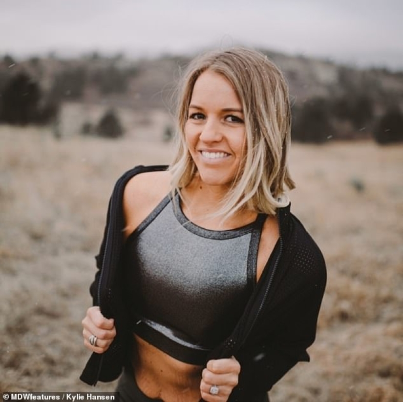 From extreme to extreme: a woman lost 50 kg, but could not stop there