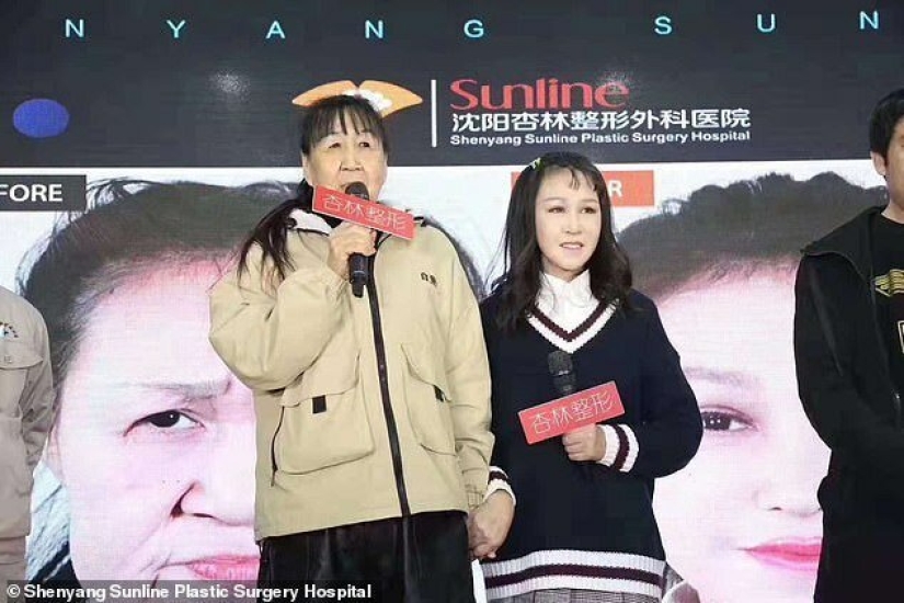 From grandmother to girl: a 15-year-old Chinese woman with an old woman's face underwent surgery From grandmother to girl: a 15-year-old Chinese woman with an old woman's face underwent surgery