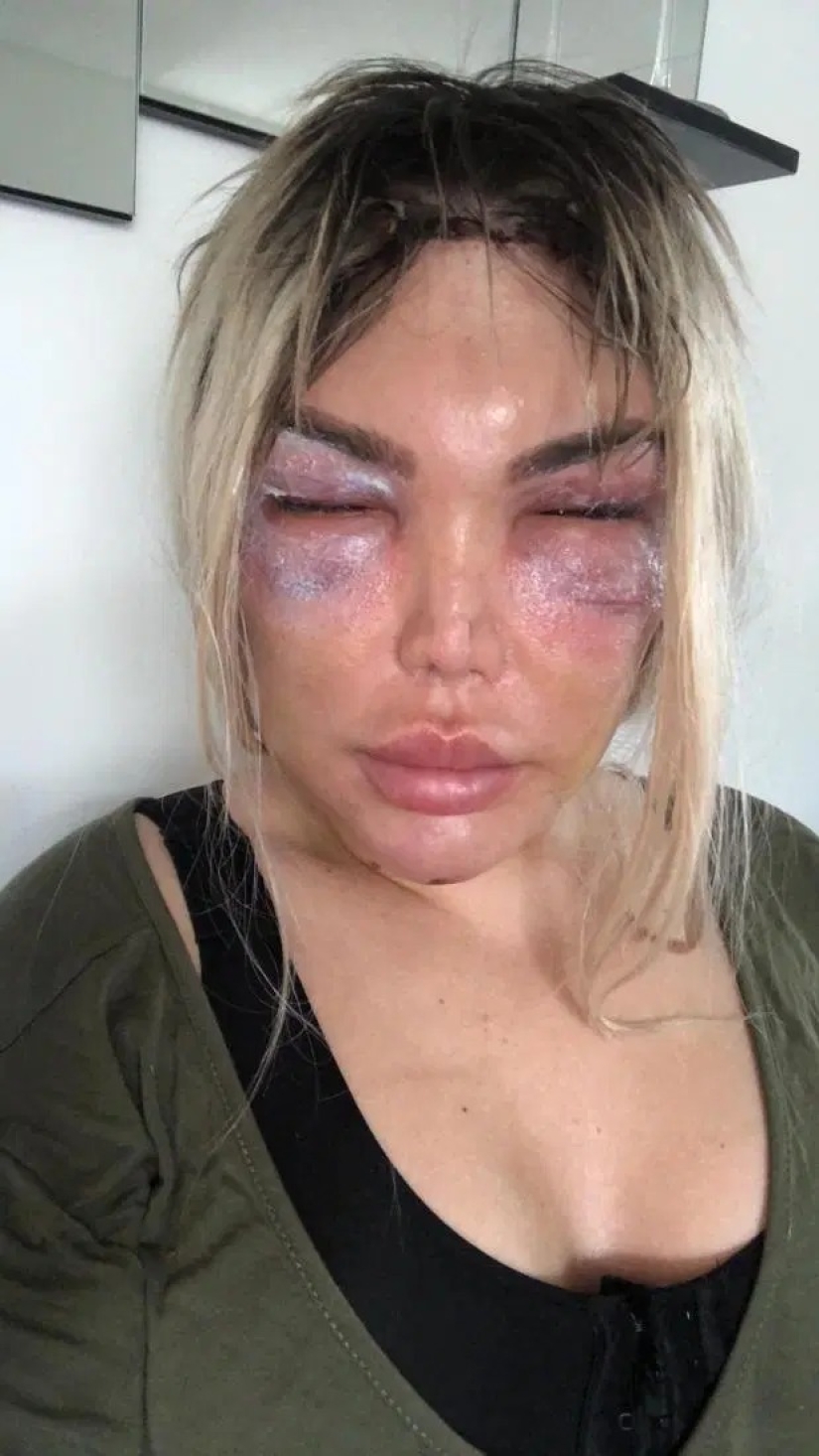 From Ken to Barbie: the human doll has changed gender and plans to become a mother