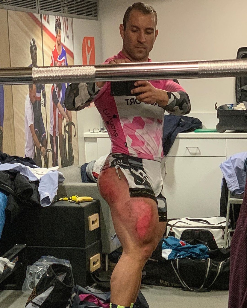 German cyclist nicknamed Quadzilla strikes with super-pumped hips