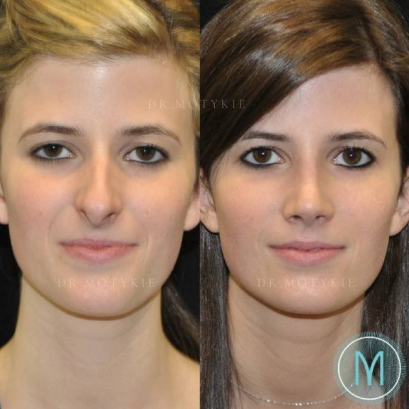 Girls before and after just one change in appearance