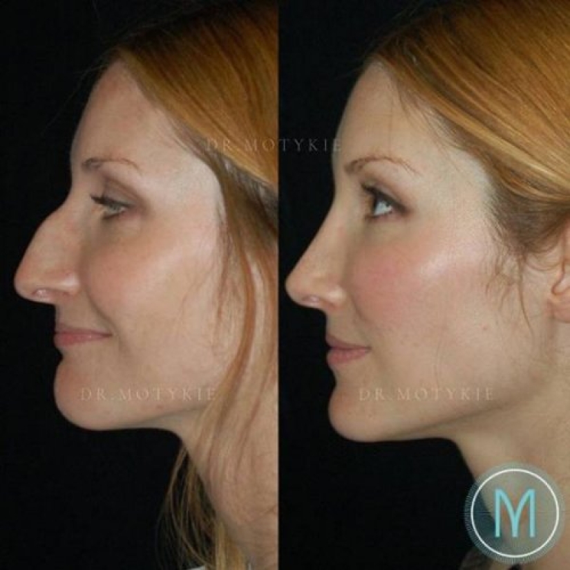 Girls before and after just one change in appearance