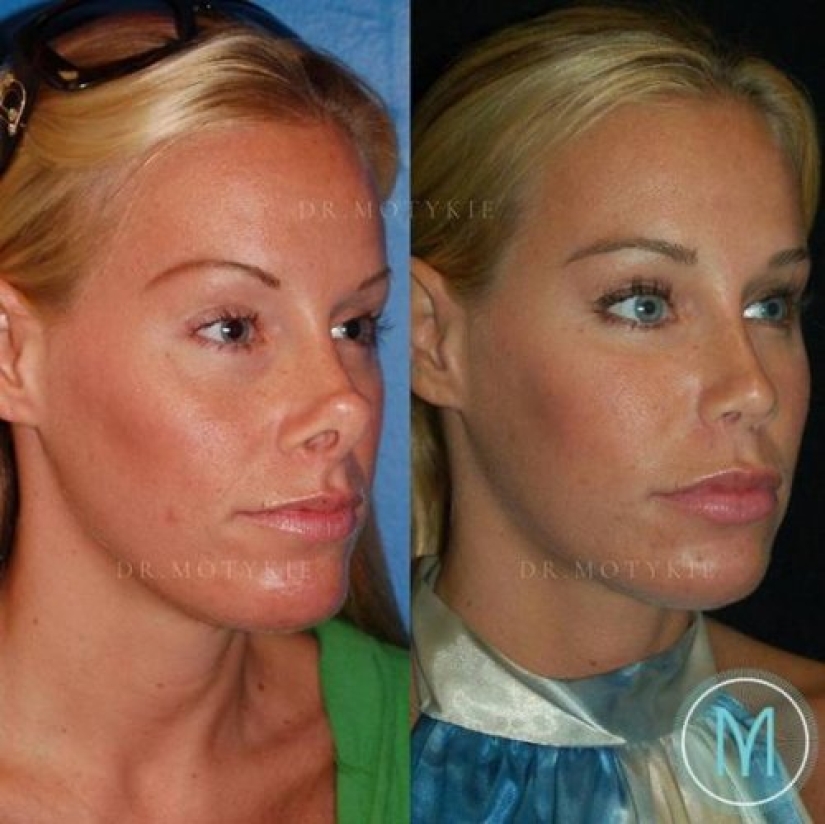 Girls before and after just one change in appearance