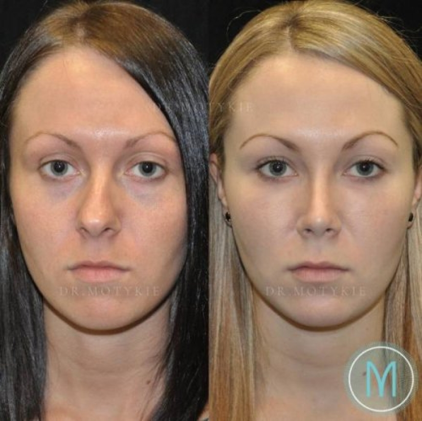 Girls before and after just one change in appearance