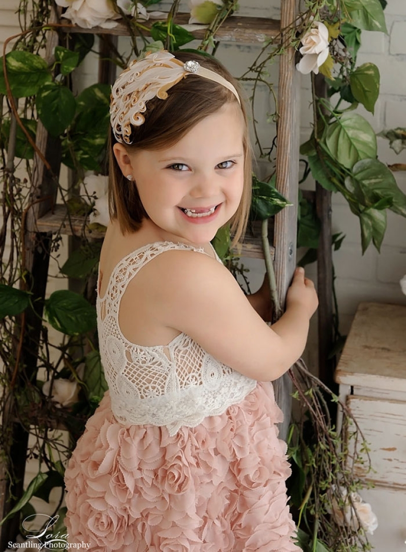 Having defeated cancer, the girls repeated the photo shoot taken at the beginning of the journey Having defeated cancer, the girls repeated the photo shoot taken at the beginning of the journey