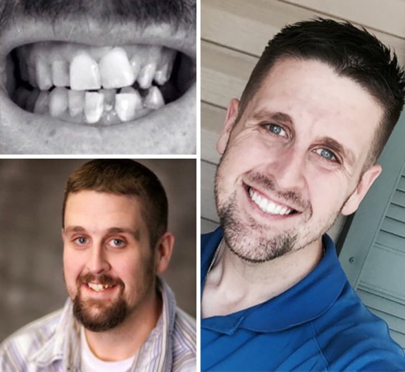 Here's how radically braces change a smile and life