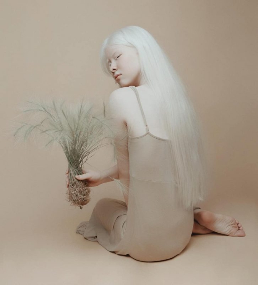 Hermanas albinas de Kazajstán conquistan el mundo del modelaje