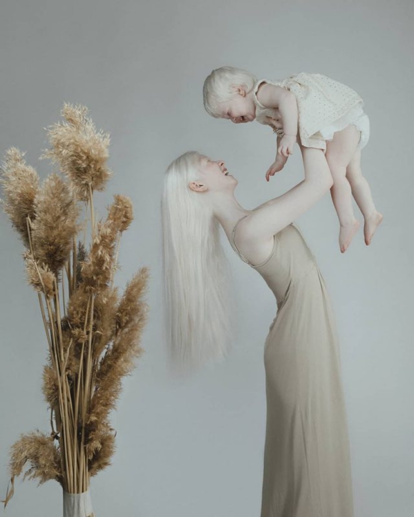 Hermanas albinas de Kazajstán conquistan el mundo del modelaje