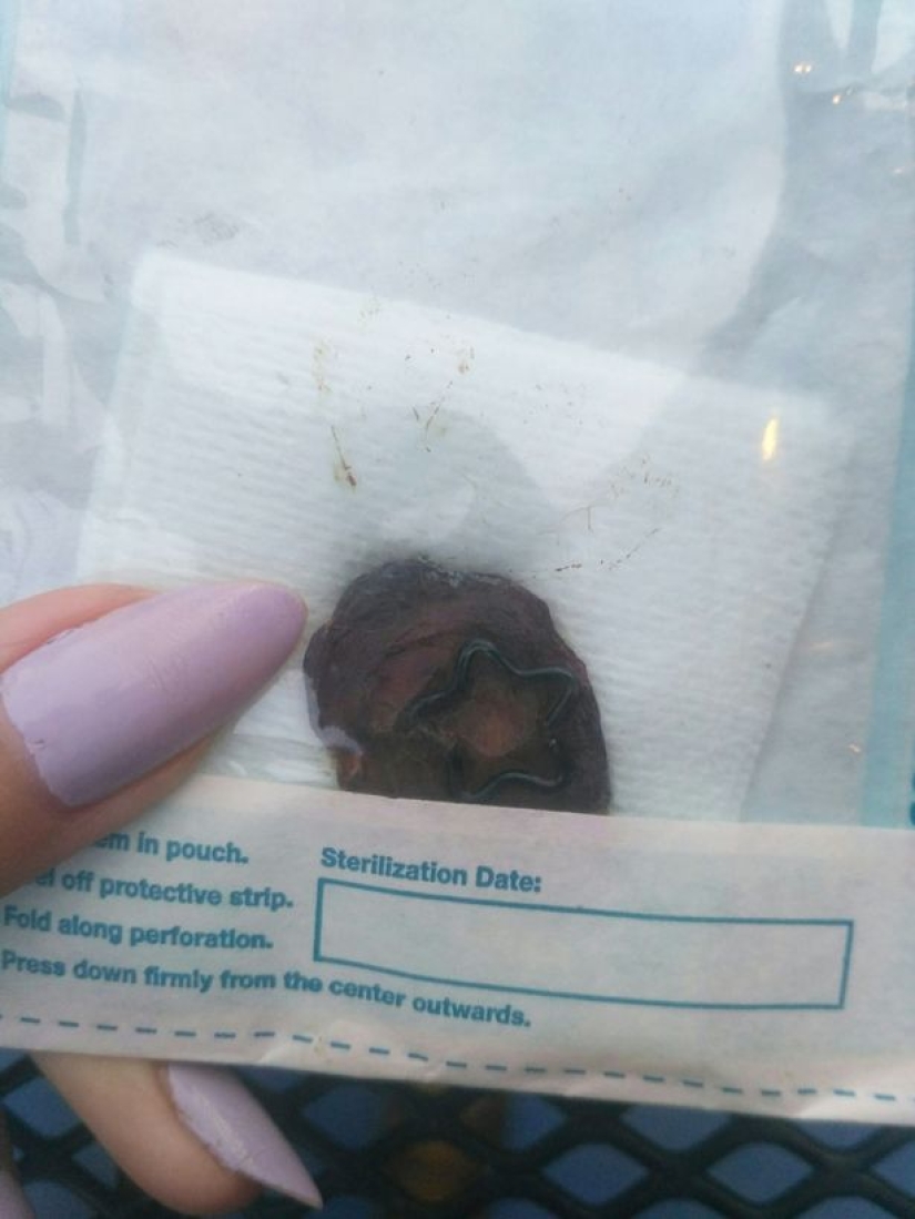 "Honey, this is for you": A 23-year-old girl removed her navel and gave it to her boyfriend