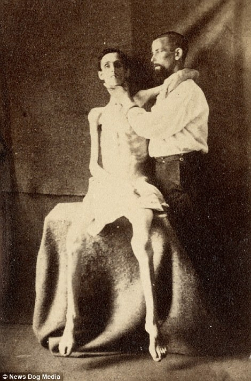 Horrifying photos of victims of the bloodiest war in US history Horrifying photos of victims of the bloodiest war in US history