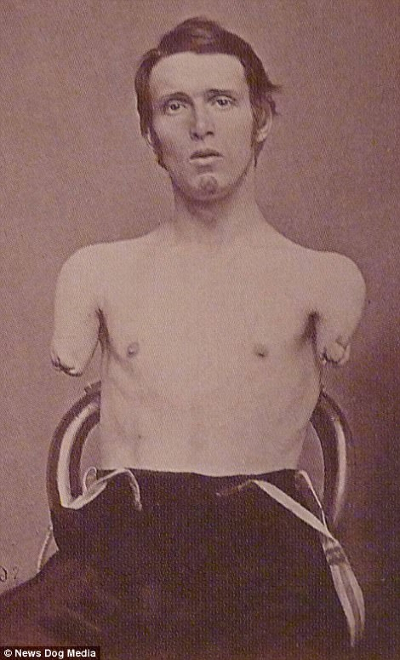 Horrifying photos of victims of the bloodiest war in US history Horrifying photos of victims of the bloodiest war in US history