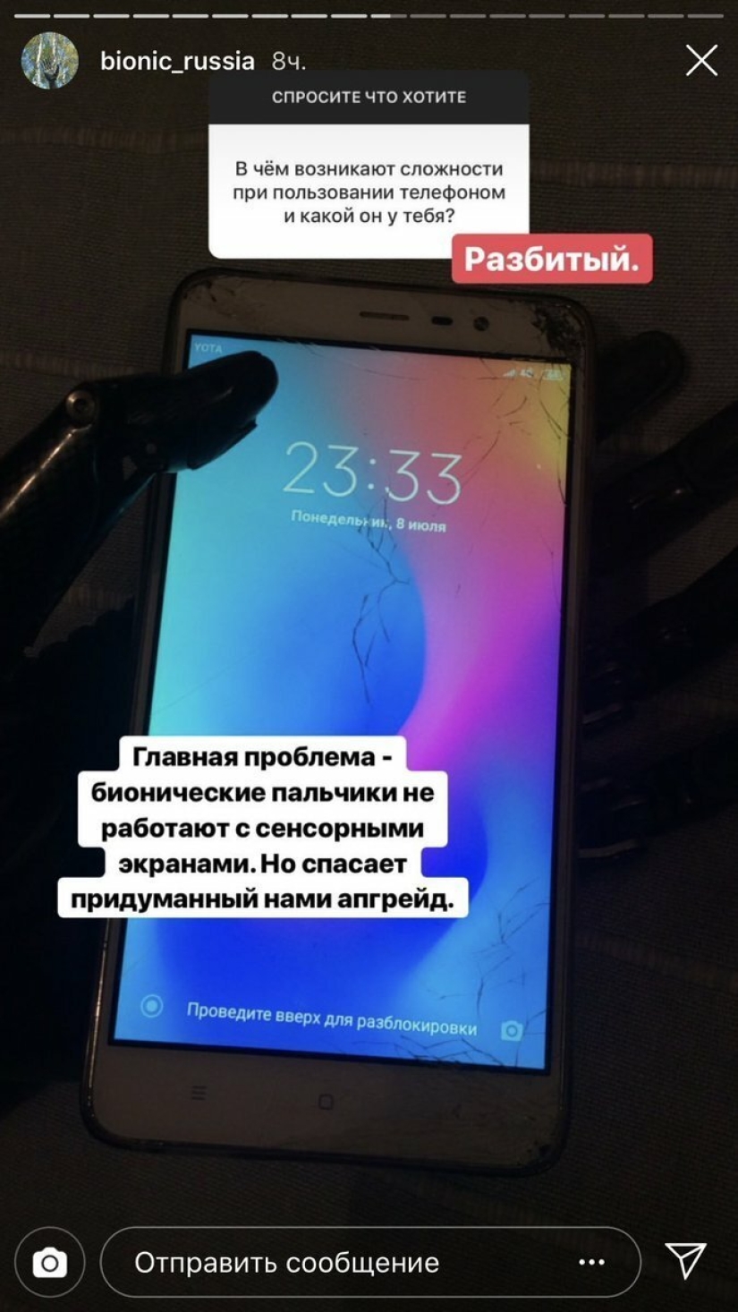 How cyborg Kostya lives: revelations of a guy without hands How cyborg Kostya lives: revelations of a guy without hands
