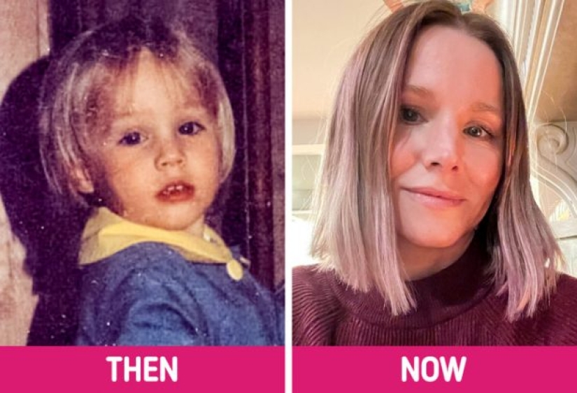 How Famous Actresses Looked Before Fame