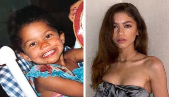 How Famous Actresses Looked Before Fame