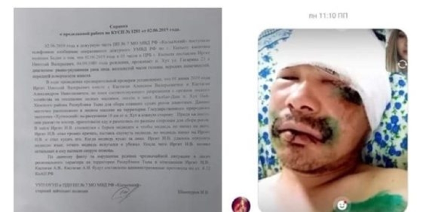 How harsh Siberians are: a resident of Tyva fought off a bear by biting off his tongue How harsh Siberians are: a resident of Tyva fought off a bear by biting off his tongue