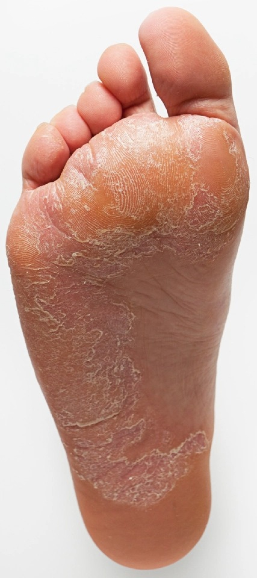 How the feet display the state of health — 8 signals about serious diseases