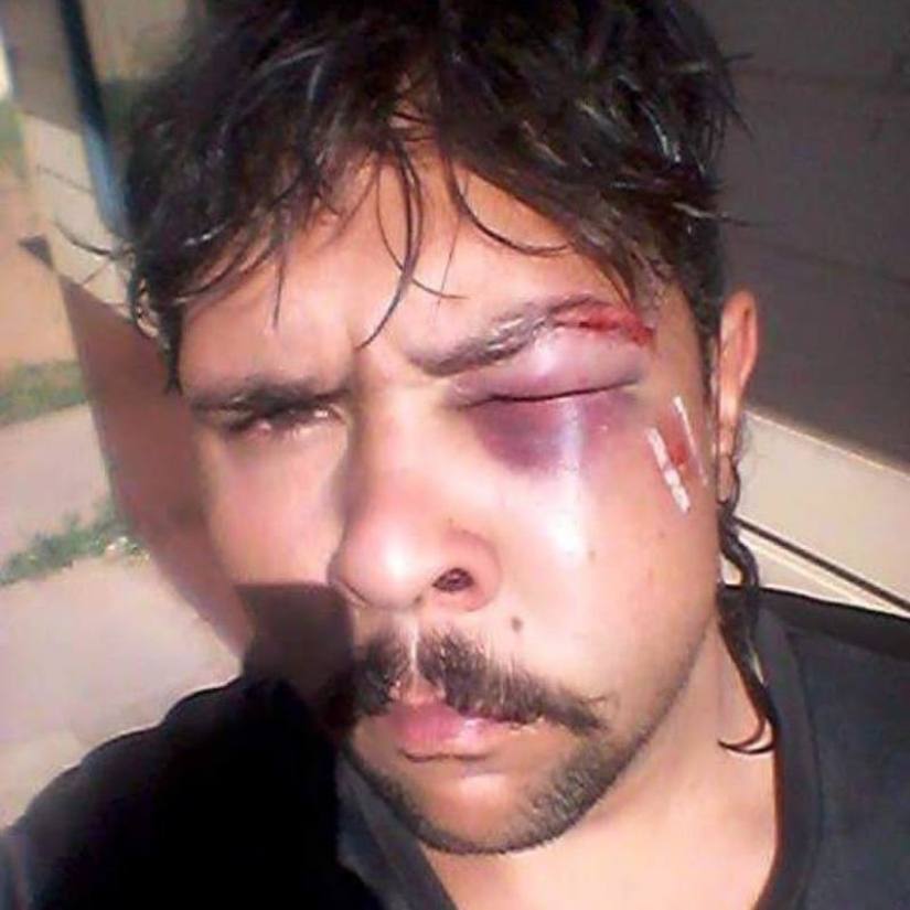 In Australia, a kangaroo knocked out a hunter by breaking his jaw