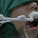 In China, a robot dentist inserted human teeth for the first time