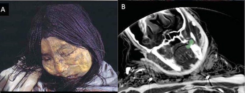 Inca mummies of sacrificed children and women